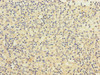 Immunohistochemistry of paraffin-embedded human spleen tissue using CSB-PA897465LA01HU at dilution of 1:100