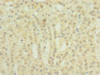 Immunohistochemistry of paraffin-embedded human adrenal gland tissue using CSB-PA897567LA01HU at dilution of 1:100