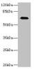 Western blot<br />
 All lanes: CAPN6 antibody at 5µg/ml + Human placenta tissue<br />
 Secondary<br />
 Goat polyclonal to rabbit IgG at 1/10000 dilution<br />
 Predicted band size: 75 kDa<br />
 Observed band size: 75 kDa<br />
