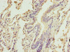 Immunohistochemistry of paraffin-embedded human lung tissue using CSB-PA897594LA01HU at dilution of 1:100