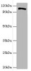 Western blot<br />
 All lanes: HIP1 antibody at 4µg/ml + A549 whole cell lysate<br />
 Secondary<br />
 Goat polyclonal to rabbit IgG at 1/10000 dilution<br />
 Predicted band size: 117, 111, 114 kDa<br />
 Observed band size: 117 kDa<br />