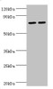 Western blot<br />
 All lanes: Arachidonate 15-lipoxygenase B antibody at 11µg/ml<br />
 Lane 1: MCF-7 whole cell lysate<br />
 Lane 2: 293T whole cell lysate<br />
 Secondary<br />
 Goat polyclonal to rabbit IgG at 1/10000 dilution<br />
 Predicted band size: 76, 68, 70, 73 kDa<br />
 Observed band size: 76 kDa<br />