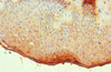 Immunohistochemistry of paraffin-embedded human skin tissue using CSB-PA001622ESR2HU at dilution of 1:100