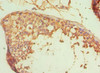 Immunohistochemistry of paraffin-embedded human testis tissue using CSB-PA001565ESR1HU at dilution of 1:100