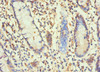 Immunohistochemistry of paraffin-embedded human small intestine tissue using CSB-PA010087ESR2HU at dilution of 1:100