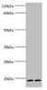 Western blot<br />
 All lanes: Serglycin antibody at 9µg/ml<br />
 Lane 1: THP-1 whole cell lysate<br />
 Lane 2: HL60 whole cell lysate<br />
 Secondary<br />
 Goat polyclonal to rabbit IgG at 1/10000 dilution<br />
 Predicted band size: 18 kDa<br />
 Observed band size: 18 kDa<br />