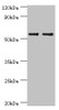 Western blot<br />
 All lanes: SLC2A1 antibody at 6µg/ml<br />
 Lane 1: NIH/3T3 whole cell lysate<br />
 Lane 2: Hela whole cell lysate<br />
 Secondary<br />
 Goat polyclonal to rabbit IgG at 1/10000 dilution<br />
 Predicted band size: 54 kDa<br />
 Observed band size: 54 kDa<br />