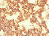 Immunohistochemistry of paraffin-embedded human lung tissue using CSB-PA016051ESR2HU at dilution of 1:100