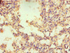 Immunohistochemistry of paraffin-embedded human lung tissue using CSB-PA016051ESR1HU at dilution of 1:100