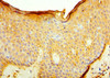 Immunohistochemistry of paraffin-embedded human skin tissue using CSB-PA011670ESR1HU at dilution of 1:100