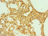 Immunohistochemistry of paraffin-embedded human lung tissue using CSB-PA007765ESR1HU at dilution of 1:100