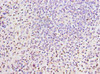 Immunohistochemistry of paraffin-embedded human spleen tissue using CSB-PA013214DSR1HU at dilution of 1:100