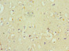 Immunohistochemistry of paraffin-embedded human brain tissue using CSB-PA002415ESR2HU at dilution of 1:100