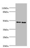 Western blot<br />
 All lanes: Serpin H1 antibody at 2µg/ml<br />
 Lane 1: NIH/3T3 whole cell lysate<br />
 Lane 2: A2780 whole cell lysate<br />
 Secondary<br />
 Goat polyclonal to rabbit IgG at 1/10000 dilution<br />
 Predicted band size: 46 kDa<br />
 Observed band size: 46 kDa<br />