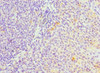 Immunohistochemistry of paraffin-embedded human tonsil tissue using CSB-PA021087ESR2HU at dilution of 1:100