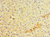 Immunohistochemistry of paraffin-embedded human liver tissue using CSB-PA002118ESR1HU at dilution of 1:100