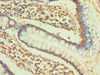 Immunohistochemistry of paraffin-embedded human small intestine tissue using CSB-PA005739ESR2HU at dilution of 1:100