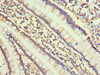 Immunohistochemistry of paraffin-embedded human small intestine tissue using CSB-PA005739ESR1HU at dilution of 1:100