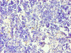 Immunohistochemistry of paraffin-embedded human thymus tissue using CSB-PA004946ESR1HU at dilution of 1:100