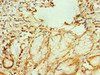 Immunohistochemistry of paraffin-embedded human gallbladder tissue using CSB-PA340572ESR1HU at dilution of 1:100