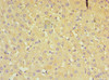 Immunohistochemistry of paraffin-embedded human liver tissue using CSB-PA001576ESR2HU at dilution of 1:100