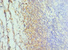 Immunohistochemistry of paraffin-embedded human tonsil tissue using CSB-PA600856ESR1HU at dilution of 1:100