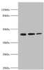 Western blot<br />
 All lanes: Actin-related protein 2 antibody at 3µg/ml<br />
 Lane 1: Mouse spleen tissue<br />
 Lane 2: Jurkat whole cell lysate<br />
 Lane 3: MCF-7 whole cell lysate<br />
 Secondary<br />
 Goat polyclonal to rabbit IgG at 1/10000 dilution<br />
 Predicted band size: 45, 46 kDa<br />
 Observed band size: 45 kDa<br />