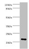 Western blot<br />
 All lanes: Peroxiredoxin-1 antibody at 2µg/ml + Hela whole cell lysate<br />
 Secondary<br />
 Goat polyclonal to rabbit IgG at 1/10000 dilution<br />
 Predicted band size: 22 kDa<br />
 Observed band size: 22 kDa<br />