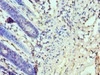 Immunohistochemistry of paraffin-embedded human colon tissue using CSB-PA613268ESR1HU at dilution of 1:100