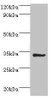 Western blot<br />
 All lanes: Aminoacyl tRNA synthase complex-interacting multifunctional protein 1 antibody at 2µg/ml + HepG2 whole cell lysate<br />
 Secondary<br />
 Goat polyclonal to rabbit IgG at 1/10000 dilution<br />
 Predicted band size: 35, 38 kDa<br />
 Observed band size: 35 kDa<br />