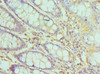 Immunohistochemistry of paraffin-embedded human colon tissue using CSB-PA023424ESR1HU at dilution of 1:100