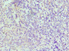 Immunohistochemistry of paraffin-embedded human tonsil tissue using CSB-PA011819ESR2HU at dilution of 1:100