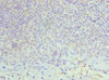 Immunohistochemistry of paraffin-embedded human tonsil tissue using CSB-PA618894ESR2HU at dilution of 1:100