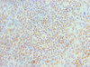 Immunohistochemistry of paraffin-embedded human tonsil tissue using CSB-PA618894ESR1HU at dilution of 1:100