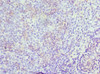 Immunohistochemistry of paraffin-embedded human tonsil tissue using CSB-PA014786ESR1HU at dilution of 1:100