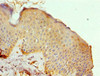Immunohistochemistry of paraffin-embedded human skin tissue using CSB-PA014786ESR1HU at dilution of 1:100