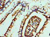 Immunohistochemistry of paraffin-embedded human small intestine tissue using CSB-PA006652ESR1HU at dilution of 1:100