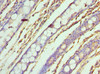 Immunohistochemistry of paraffin-embedded human colon tissue using CSB-PA896689ESR1HU at dilution of 1:100