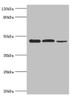 Western blot<br />
 All lanes: Eukaryotic initiation factor 4A-I antibody at 3µg/ml<br />
 Lane 1: K562 whole cell lysate<br />
 Lane 2: Hela whole cell lysate<br />
 Lane 3: Rat brain tissue<br />
 Secondary<br />
 Goat polyclonal to rabbit IgG at 1/10000 dilution<br />
 Predicted band size: 47, 40 kDa<br />
 Observed band size: 47 kDa<br />