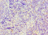 Immunohistochemistry of paraffin-embedded human tonsil tissue using CSB-PA009297ESR2HU at dilution of 1:100