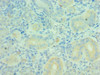 Immunohistochemistry of paraffin-embedded human pancreatic tissue using CSB-PA614418ESR1HU at dilution of 1:100