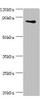 Western blot<br />
 All lanes: Interleukin enhancer-binding factor 3 antibody at 3µg/ml + HepG2 whole cell lysate<br />
 Secondary<br />
 Goat polyclonal to rabbit IgG at 1/10000 dilution<br />
 Predicted band size: 96, 77, 83, 76, 75 kDa<br />
 Observed band size: 96 kDa<br />