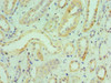 Immunohistochemistry of paraffin-embedded human kidney tissue using CSB-PA613273ESR1HU at dilution of 1:100