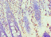 Immunohistochemistry of paraffin-embedded human colon tissue using CSB-PA010647DSR1HU at dilution of 1:100