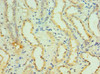 Immunohistochemistry of paraffin-embedded human kidney tissue using CSB-PA012086ESR1HU at dilution of 1:100