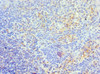 Immunohistochemistry of paraffin-embedded human tonsil tissue using CSB-PA023438DSR1HU at dilution of 1:100