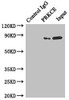 Immunoprecipitating PRKCE in MCF-7 whole cell lysate<br />
 Lane 1: Rabbit control IgG instead of (1µg) instead of CSB-PA018704ESR2HU in MCF-7 whole cell lysate. For western blotting, a HRP-conjugated anti-rabbit IgG, specific to the non-reduced form of IgG was used as the Secondary antibody (1/50000) <br />
 Lane 2: CSB-PA018704ESR2HU (4µg) + MCF-7 whole cell lysate (500µg) <br />
 Lane 3: MCF-7 whole cell lysate (20µg) <br />