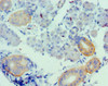 Immunohistochemistry of paraffin-embedded human pancreatic tissue using CSB-PA025771ESR1HU at dilution of 1:100