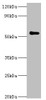 Western blot<br />
 All lanes: Poly [ADP-ribose] polymerase 3 antibody at 7µg/ml + Mouse kidney tissue<br />
 Secondary<br />
 Goat polyclonal to rabbit IgG at 1/10000 dilution<br />
 Predicted band size: 60 kDa<br />
 Observed band size: 60 kDa<br />