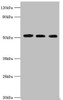 Western blot<br />
 All lanes: Programmed cell death protein 4 antibody at 5µg/ml<br />
 Lane 1: Hela whole cell lysate<br />
 Lane 2: MCF-7 whole cell lysate<br />
 Lane 3: Jurkat whole cell lysate<br />
 Secondary<br />
 Goat polyclonal to rabbit IgG at 1/10000 dilution<br />
 Predicted band size: 52, 51 kDa<br />
 Observed band size: 52 kDa<br />